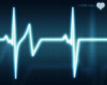 pulse, monitor Pablo631 - Dreamstime