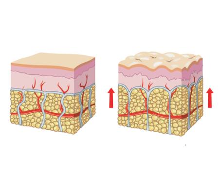 skin, blood, vein, arrow, cellular Rob3000 - Dreamstime