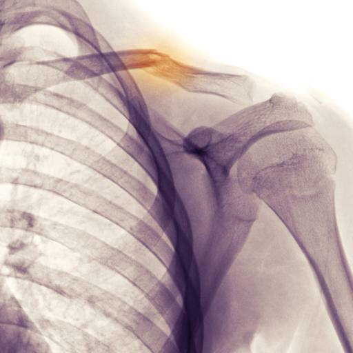 bone, bones, xray, radiography Tallik bone, bones, xray, radiography Tallik