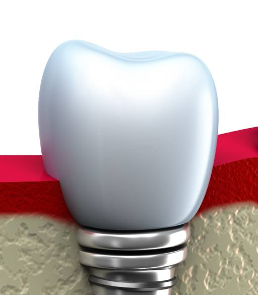 tooth, teeth, mouth, white, dentist Makarova Olga (Mildegard) tooth, teeth, mouth, white, dentist Makarova Olga (Mildegard)