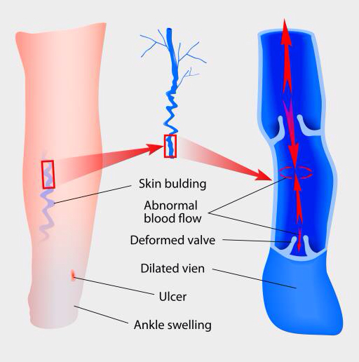 skin, leg, legs, ankle, blood, arrows, medical, medicine Designua