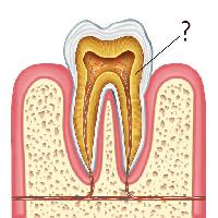 Pixwords The image with tooth, teeth, question, yellow, gold, mouth Skypixel