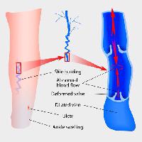 Pixwords The image with skin, leg, legs, ankle, blood, arrows, medical, medicine Designua